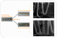 Neue degradierbare Polymerbeschichtung auf magnesiumbasierten Stents